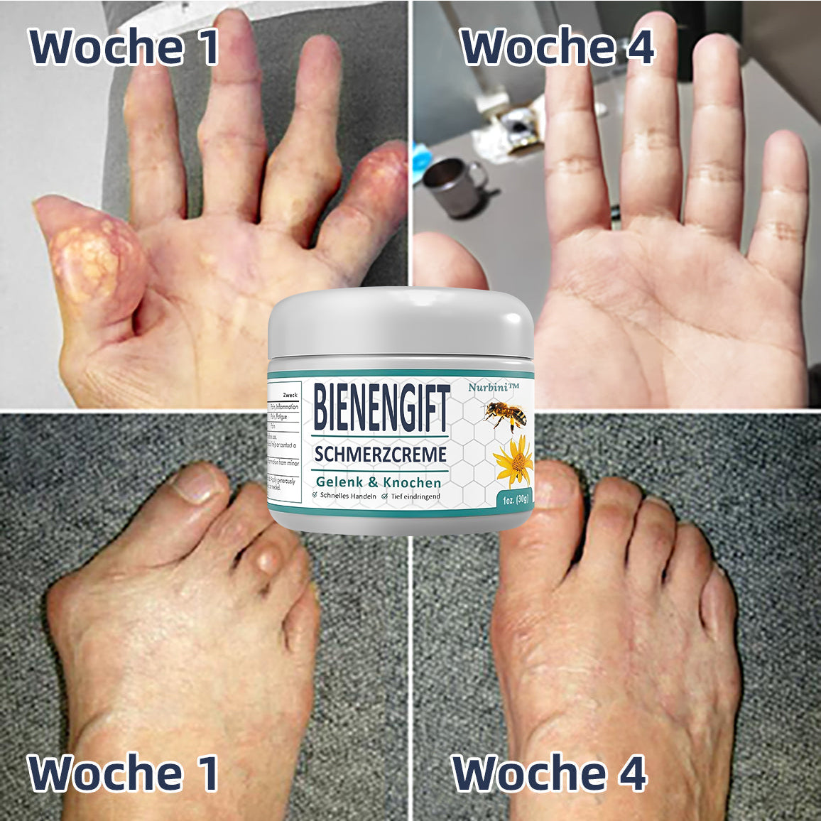 🐝🤩🐝 Bienengift Schmerz- und Knochenbehandlungscreme 💥 30-Minuten-Sonderaktion🐝🐝🐝 ⚡