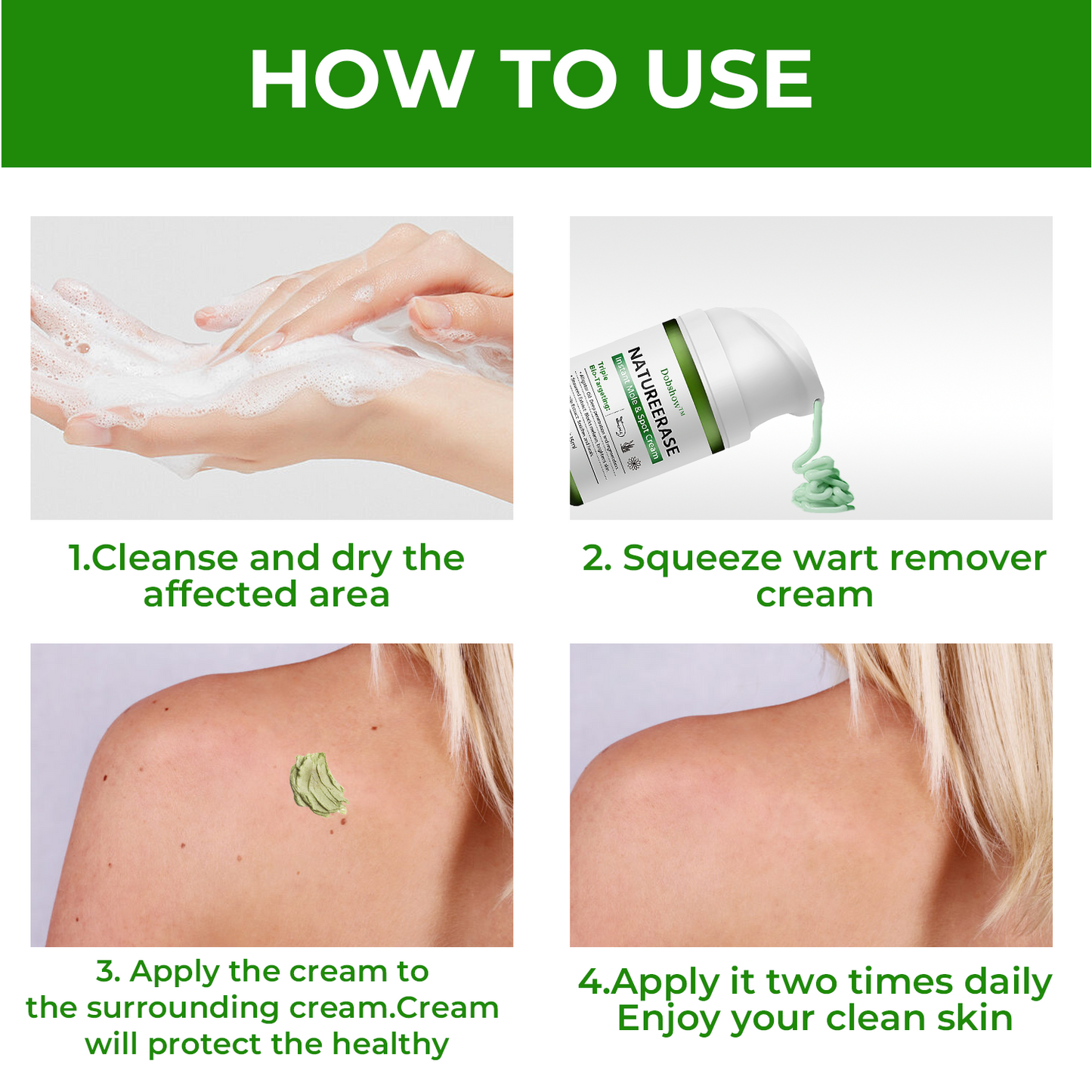 ✅ Official store: Dobshow™ NatureErase Instant Mole & Spot Cream