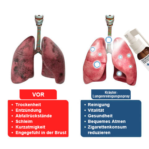 🌿Dobshow™ BreathDetox Kräuter-Lungenreinigungsspray