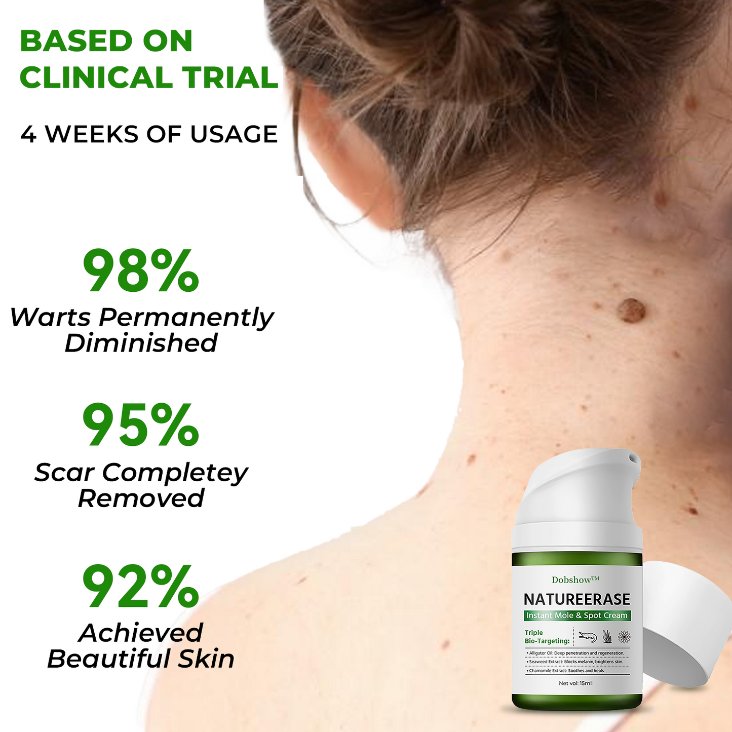✅ Official store: Dobshow™ NatureErase Instant Mole & Spot Cream