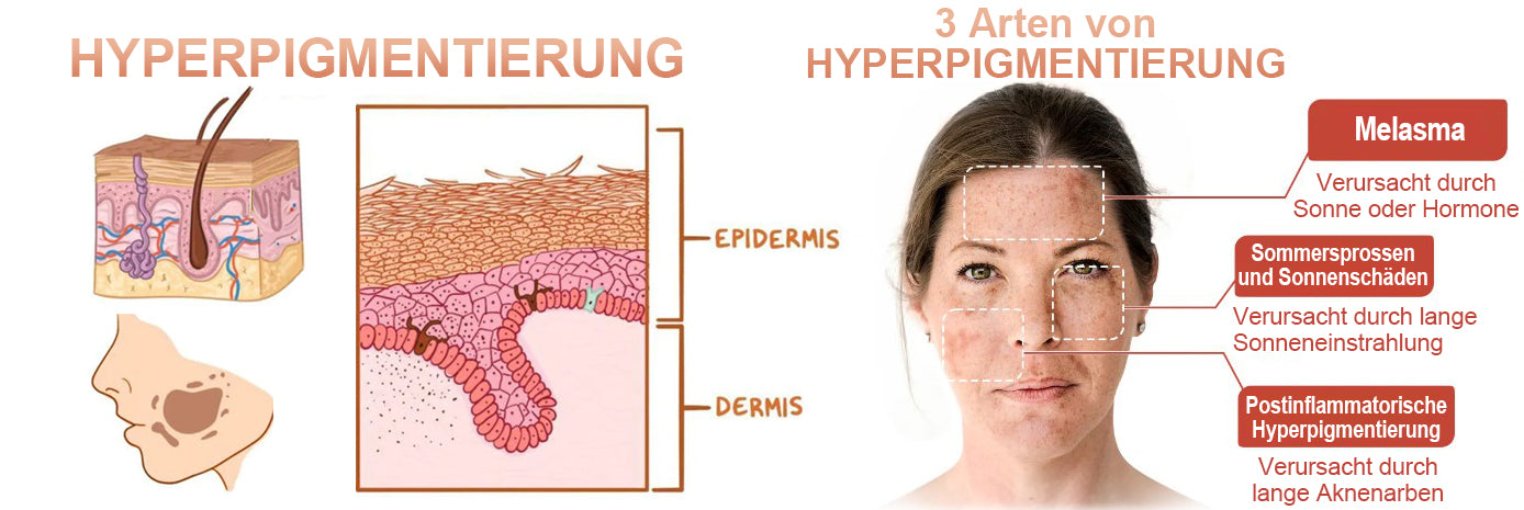 ✨🤩Schnelle Dunkle Flecken Entferner- Dobshow™ Melanin-korrigierendes Gesichtsserum💫
