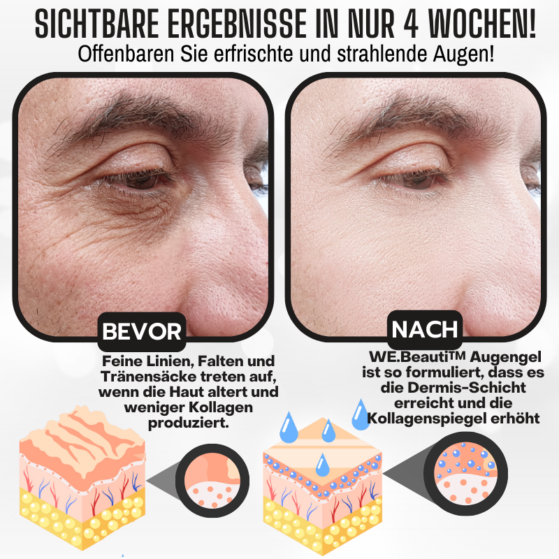 WE.Beauti™ Niacinamid Augenerwachen Gel