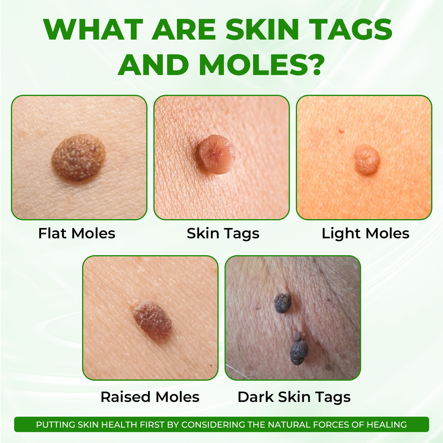✅ Official store: Dobshow™ NatureErase Instant Mole & Spot Cream