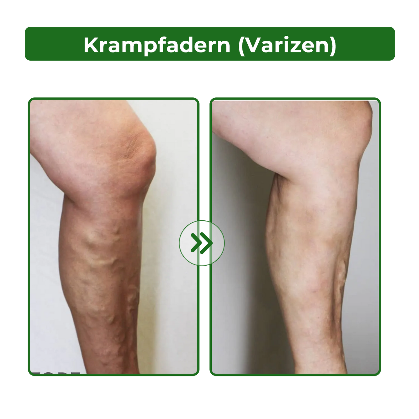 Dobshow® Lymphatische Detox-Kräutercreme|👨⚕️ 𝘿𝙚𝙪𝙩𝙨𝙘𝙝𝙚 𝙂𝙚𝙨𝙚𝙡𝙡𝙨𝙘𝙝𝙖𝙛𝙩 𝙙𝙚𝙪𝙩𝙨𝙘𝙝𝙡𝙖𝙣𝙙 𝙇𝙮𝙢𝙥𝙝𝙤𝙡𝙤𝙜𝙞𝙚, (𝘿𝙂𝙇) 𝙚𝙢𝙥𝙛𝙚𝙝𝙡𝙚