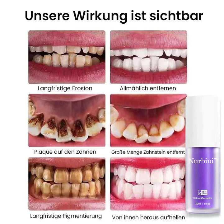 Nurbini™ Rein pflanzliches Zahnweiß-Mousse