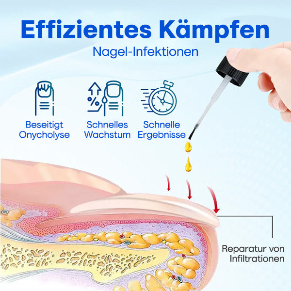 Nurbini™ OnyxoGuard Serum für Nagelwachstum und -reparatur💅