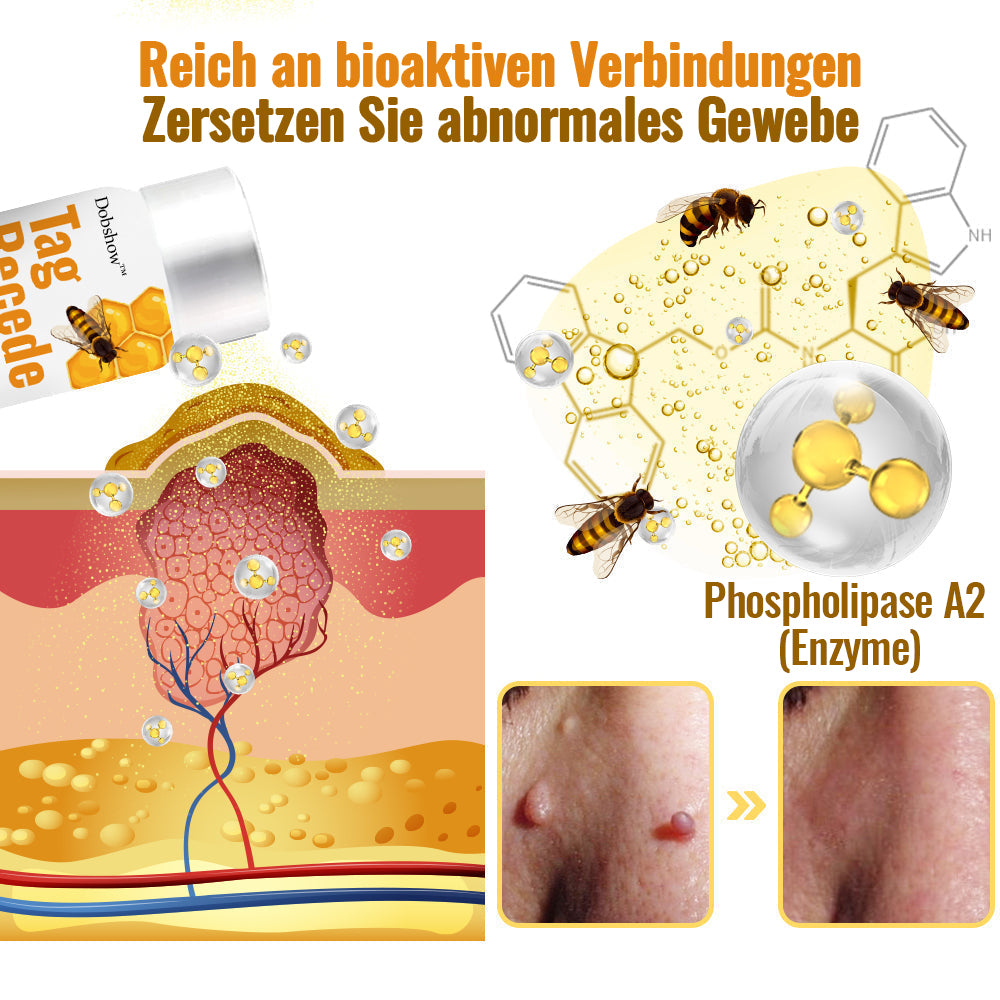 ✨🐝Dobshow™ Bienengift Hautperfektionsspray: Natürliches Entfernen von Hautmarken & Warzen🐝🌿🐝