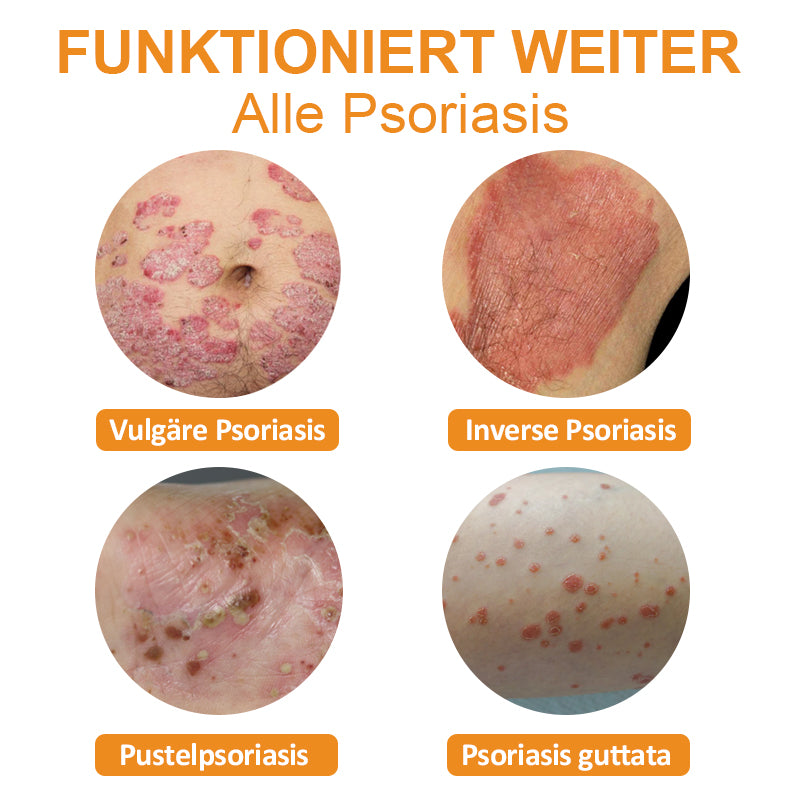 🐝🌿Dobshow™ Bienengift-Psoriasis-Linderungscreme🌿🐝(Wirksam bei allen Hauterkrankungen)🌟