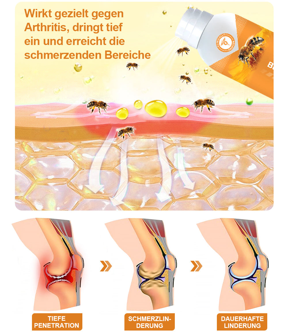 🌟🐝Dobshow™ Bienengift-Therapiespray für Gelenke und Knochen 🌿⭐⭐⭐⭐⭐ (4,9/5) Bewertet von 1.33.9834 Kunden