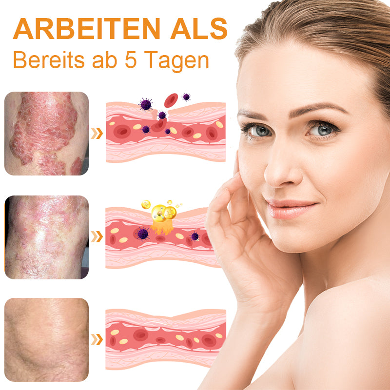 🐝🌿Dobshow™ Bienengift-Psoriasis-Linderungscreme🌿🐝(Wirksam bei allen Hauterkrankungen)🌟