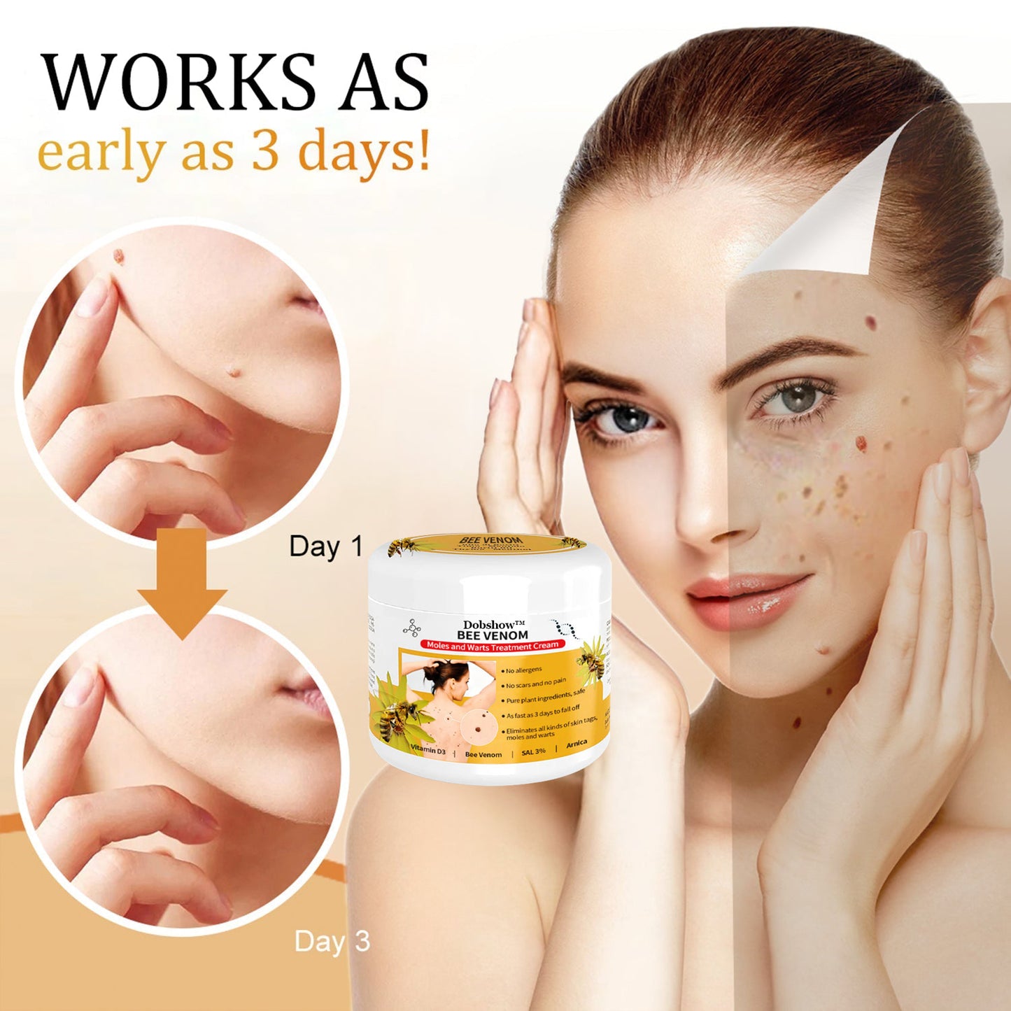 đđ DobshowâąBee Venom Mole und Warze Behandlung Creme(đšââAAD RECOMMENDS)
