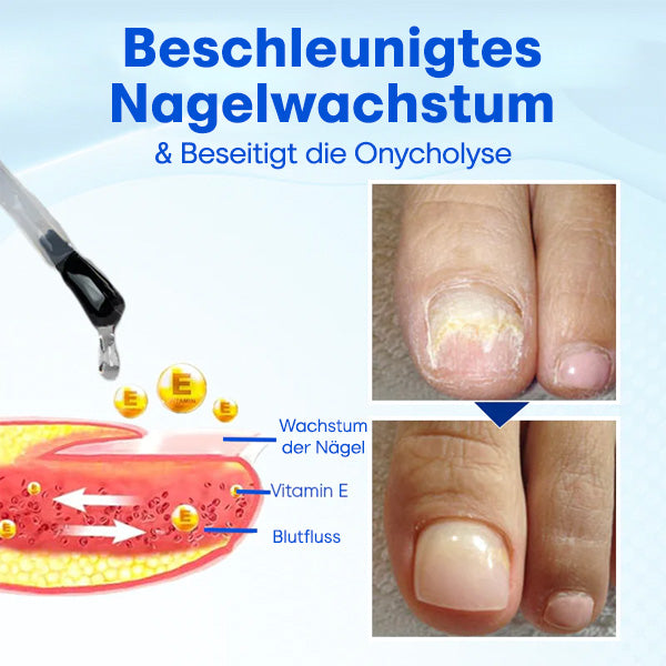 Nurbini™ OnyxoGuard Serum für Nagelwachstum und -reparatur💅
