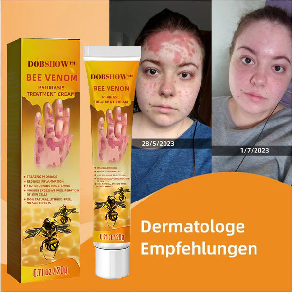 Dobshow™ Bienengift-Psoriasis-Behandlungscreme (Für alle Hautzustände geeignet)