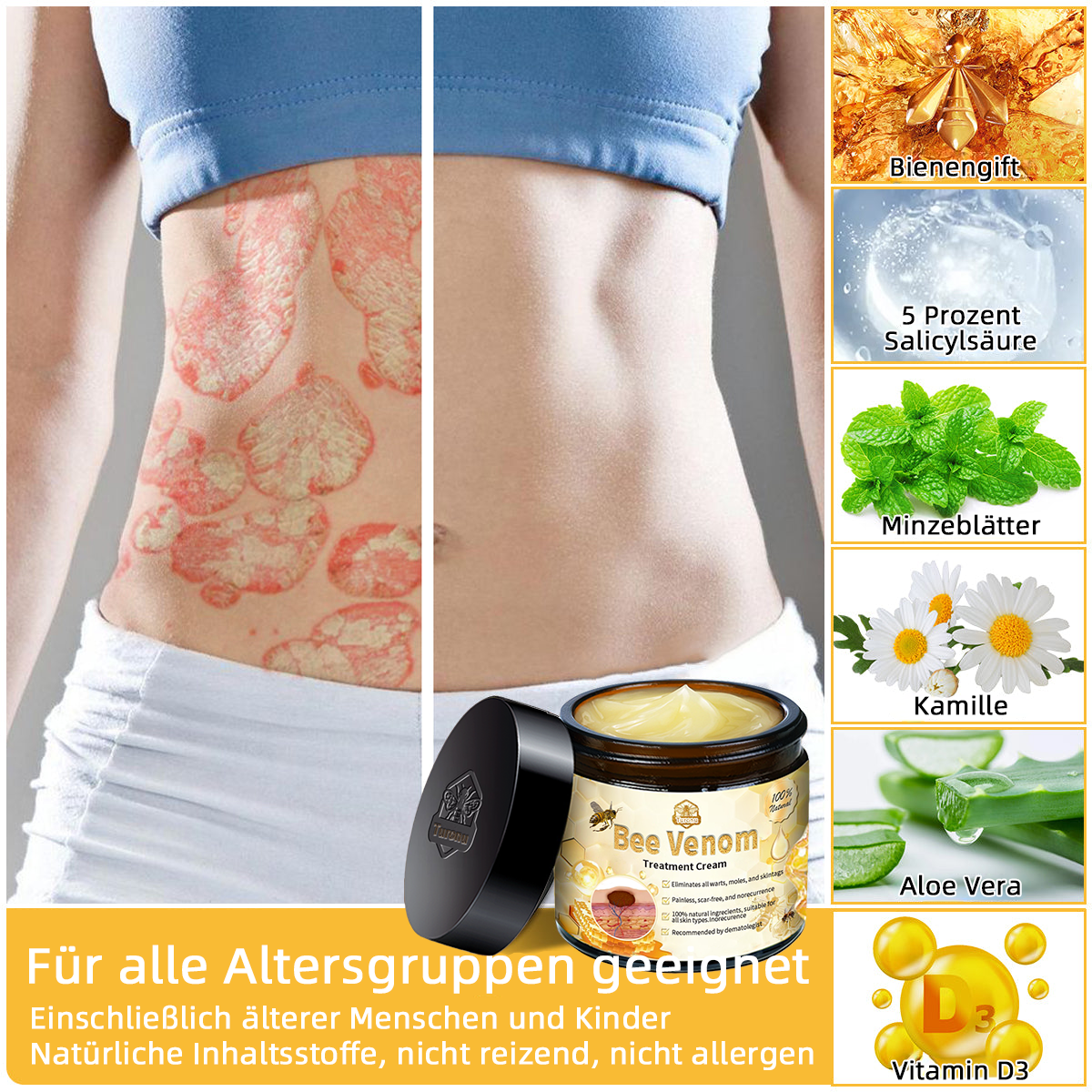 💎Turonu™ Bienengift Hautpflegecreme( BfArM Deutschland)💎
