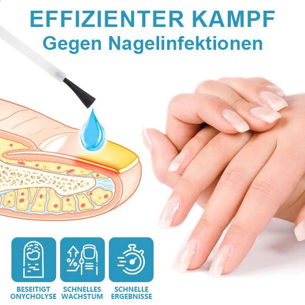 Nurbini™ OnycholysisHeal: Nagelstärkendes und Wachstumsreparatur-Essenz 💅✨