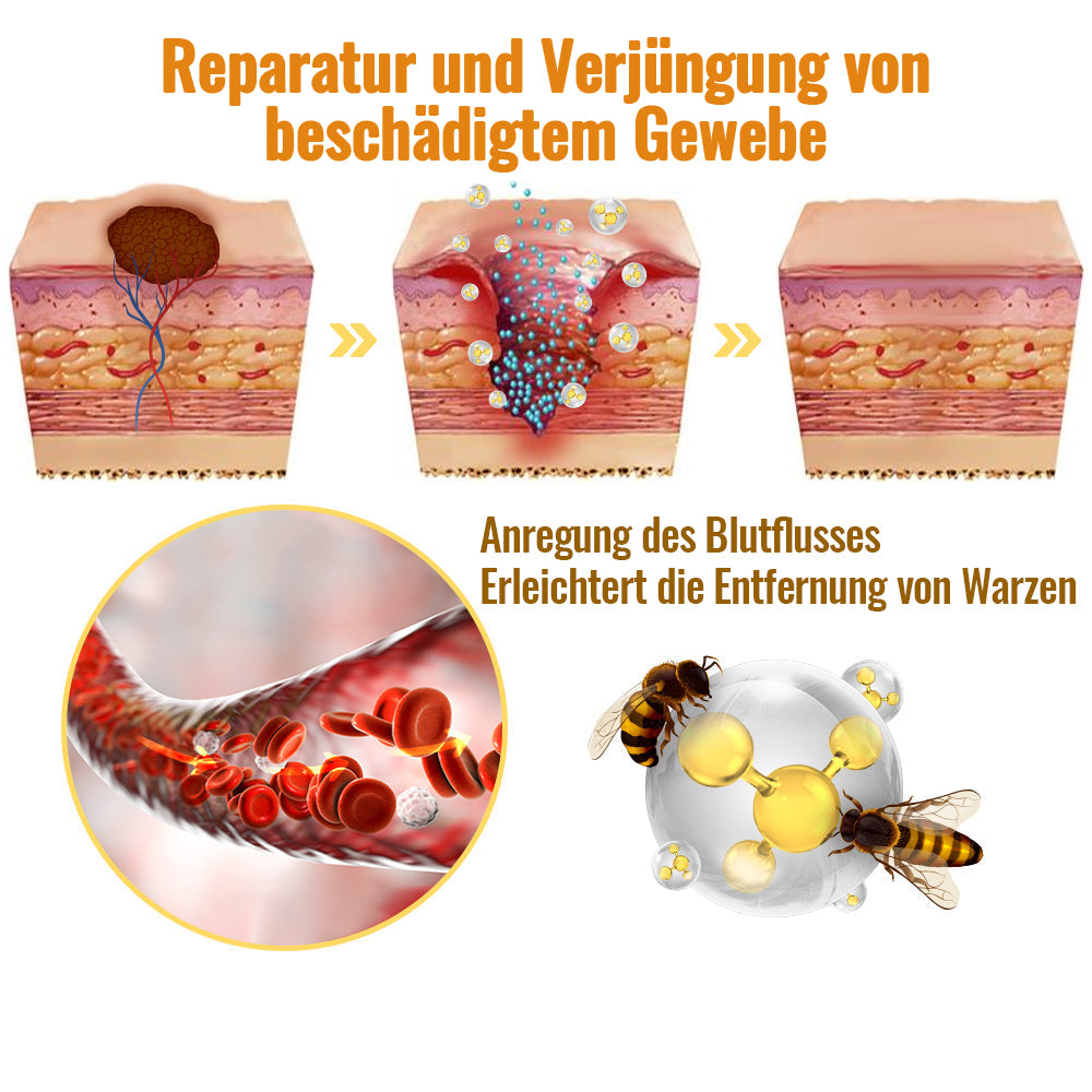 ✨🐝Dobshow™ Bienengift Hautperfektionsspray: Natürliches Entfernen von Hautmarken & Warzen🐝🌿🐝