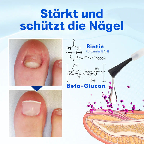 Nurbini™ OnyxoGuard Serum für Nagelwachstum und -reparatur💅