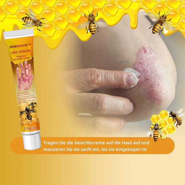 Dobshow™ Bienengift-Psoriasis-Behandlungscreme (Für alle Hautzustände geeignet)