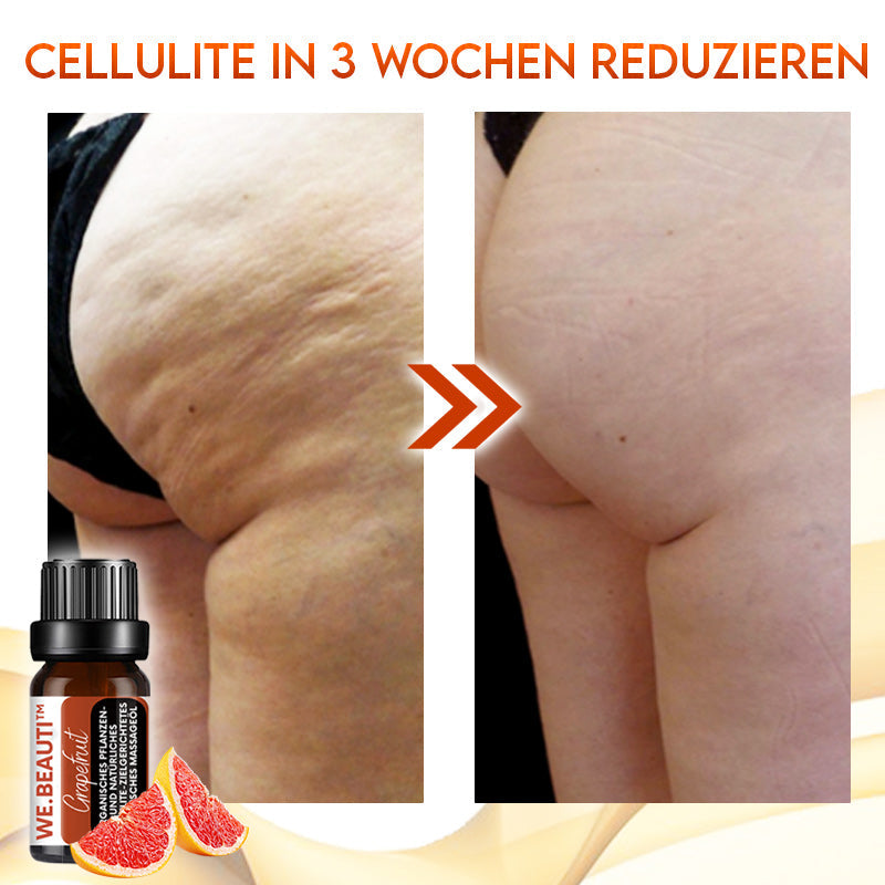WE.Beauti™ Grapefruit-Ätherisches Öl gegen Cellulitis
