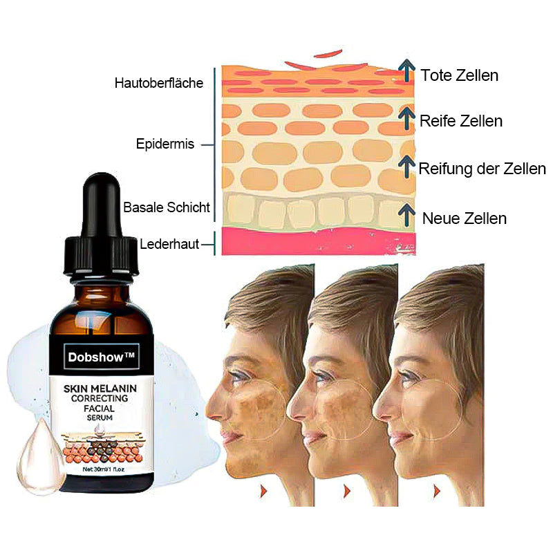 ✨🤩Schnelle Dunkle Flecken Entferner- Dobshow™ Melanin-korrigierendes Gesichtsserum💫