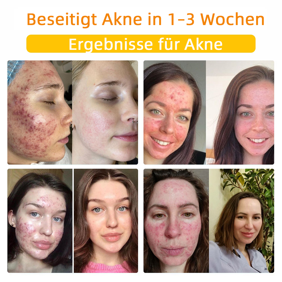 💎Turonu™ Bienengift Hautpflegecreme( BfArM Deutschland)💎