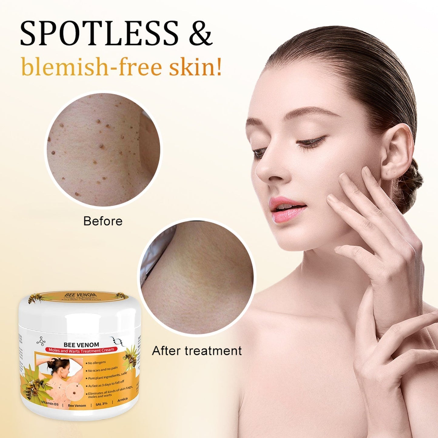 đđ DobshowâąBee Venom Mole und Warze Behandlung Creme(đšââAAD RECOMMENDS)