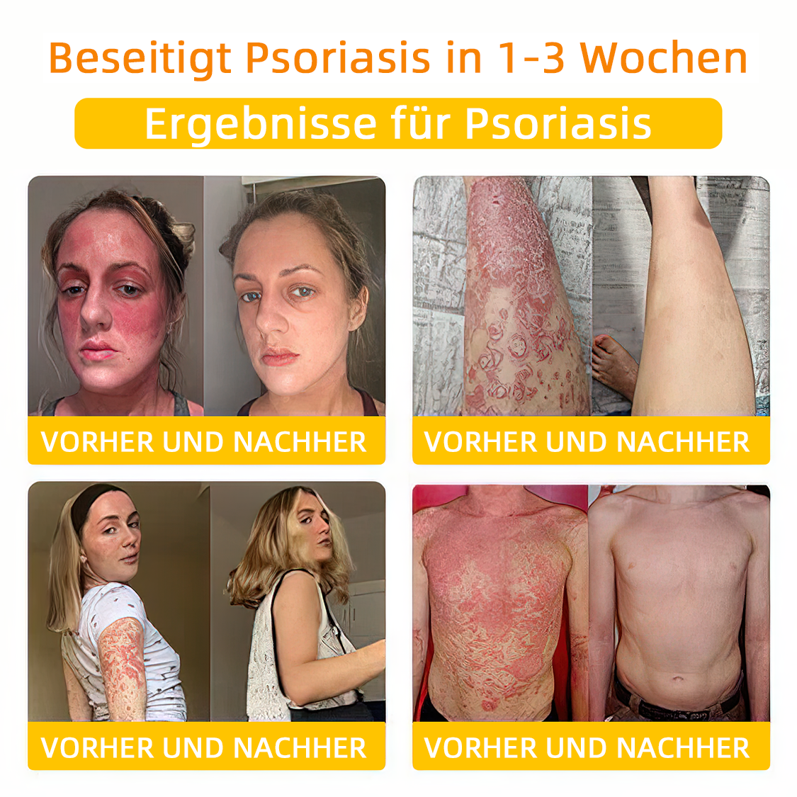 💎Turonu™ Bienengift Hautpflegecreme( BfArM Deutschland)💎