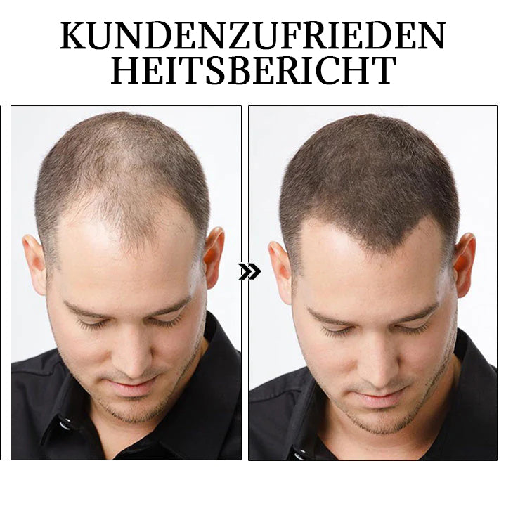 Dobshow™ Kräuter-Haarstärkungsserum