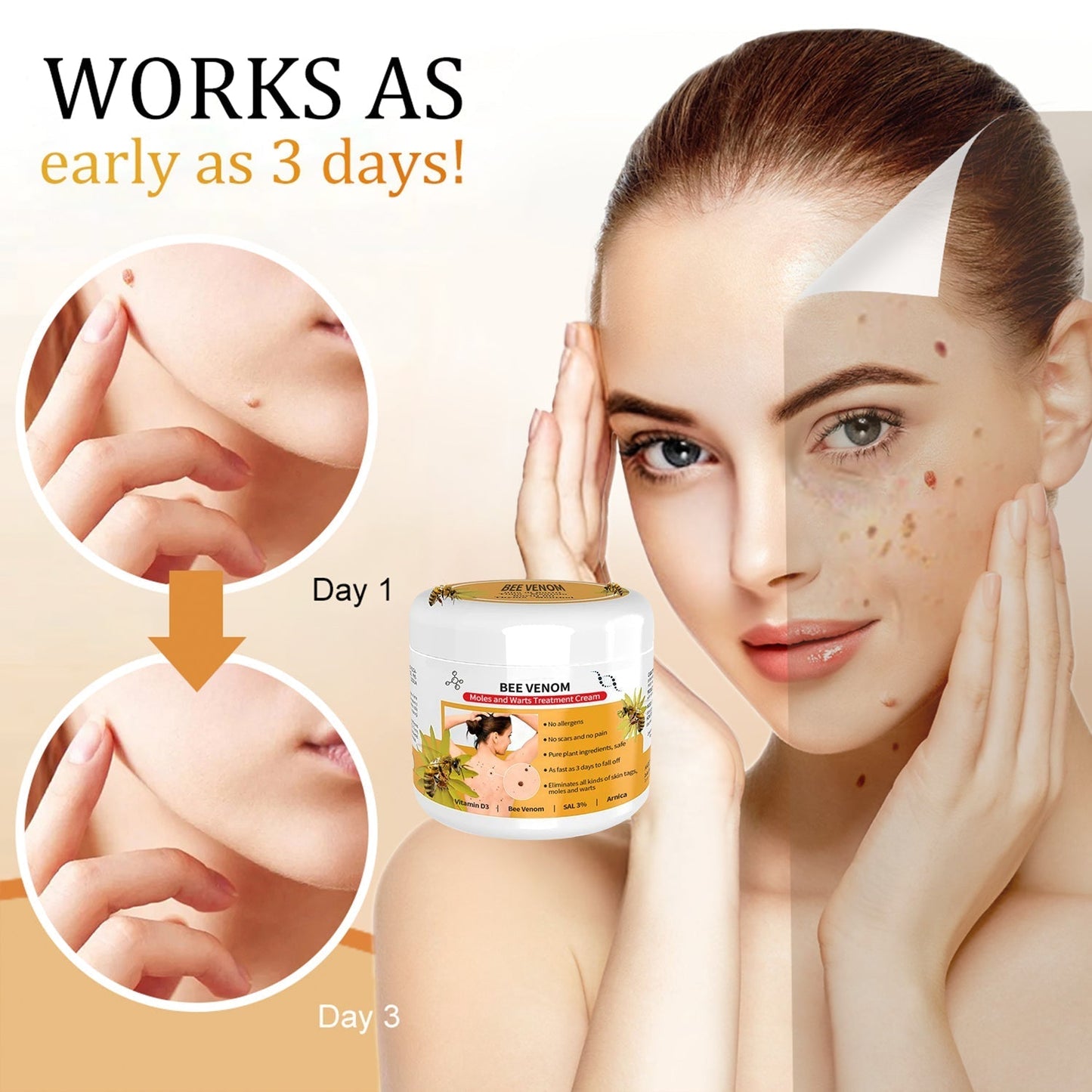 đđ DobshowâąBee Venom Mole und Warze Behandlung Creme(đšââAAD RECOMMENDS)