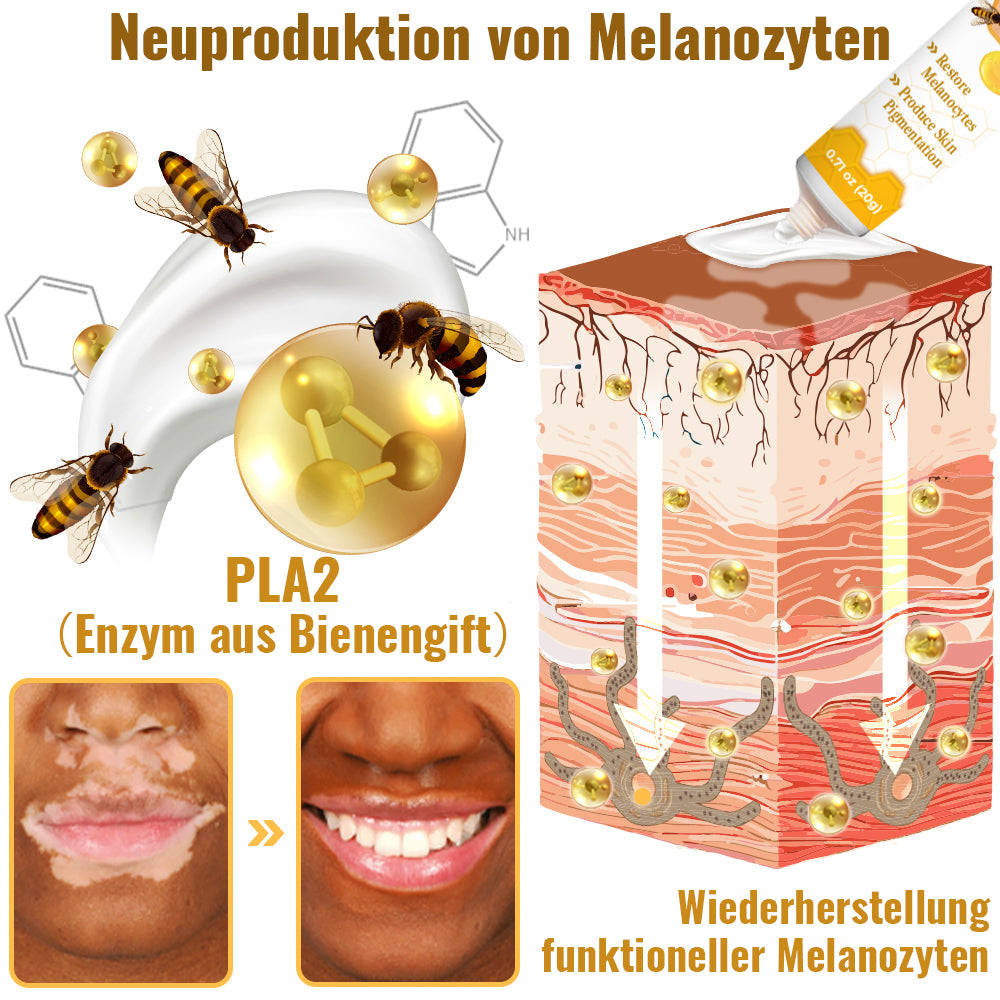 Dobshow™ BeeVenom Vitiligo Behandlungscreme