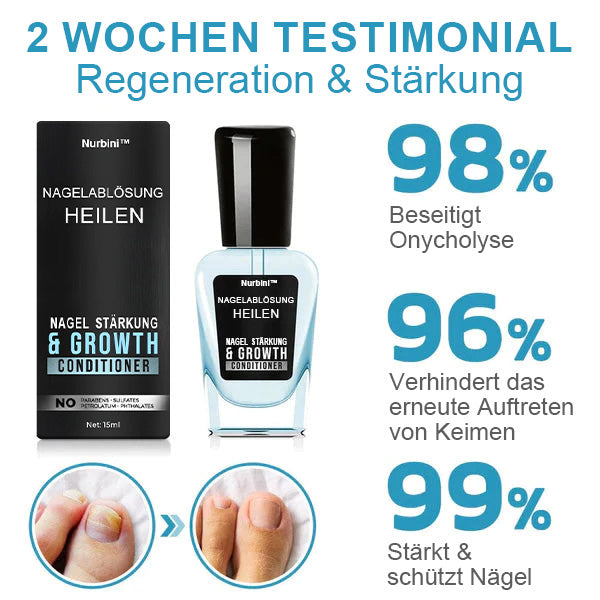 Nurbini™ OnycholysisHeal: Nagelstärkendes und Wachstumsreparatur-Essenz 💅✨
