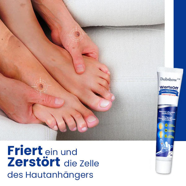 Dobshow™ WartsOff Rapid Creme zur sofortigen Entfernung von Hautunreinheiten
