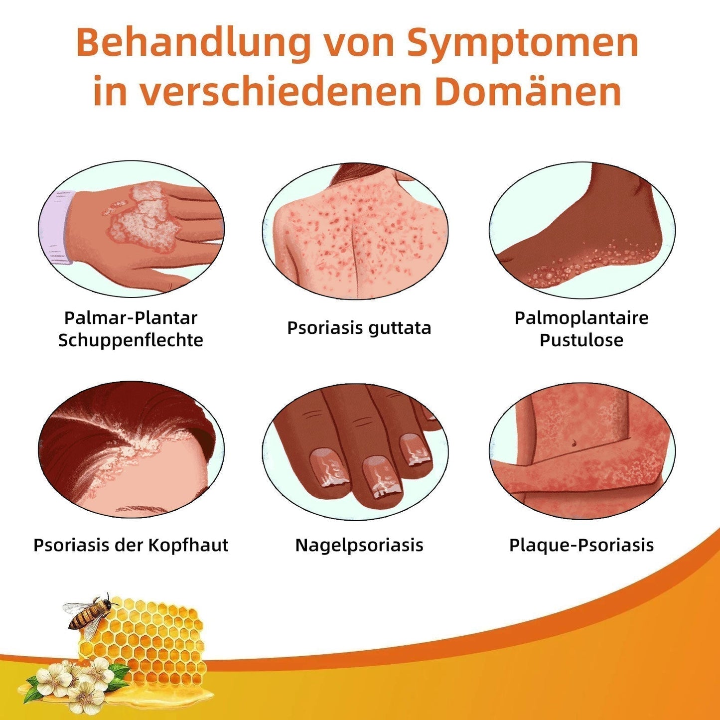 Dobshow™ Bienengift-Psoriasis-Behandlungscreme (Für alle Hautzustände geeignet)