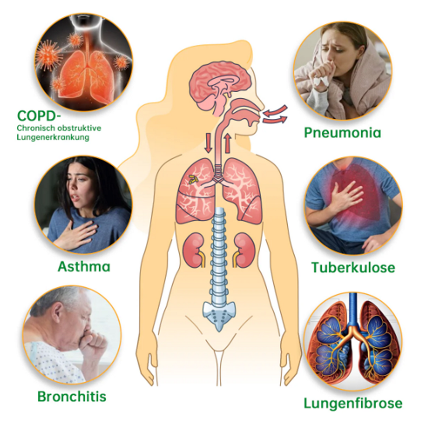 Dobshow™ 🧑⚕️herbal Lungenreinigungs-Inhalator🍃🍃