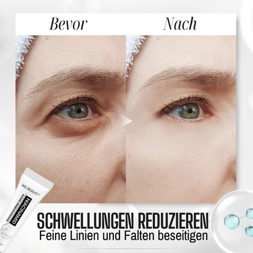 WE.Beauti™ Niacinamid Augenerwachen Gel
