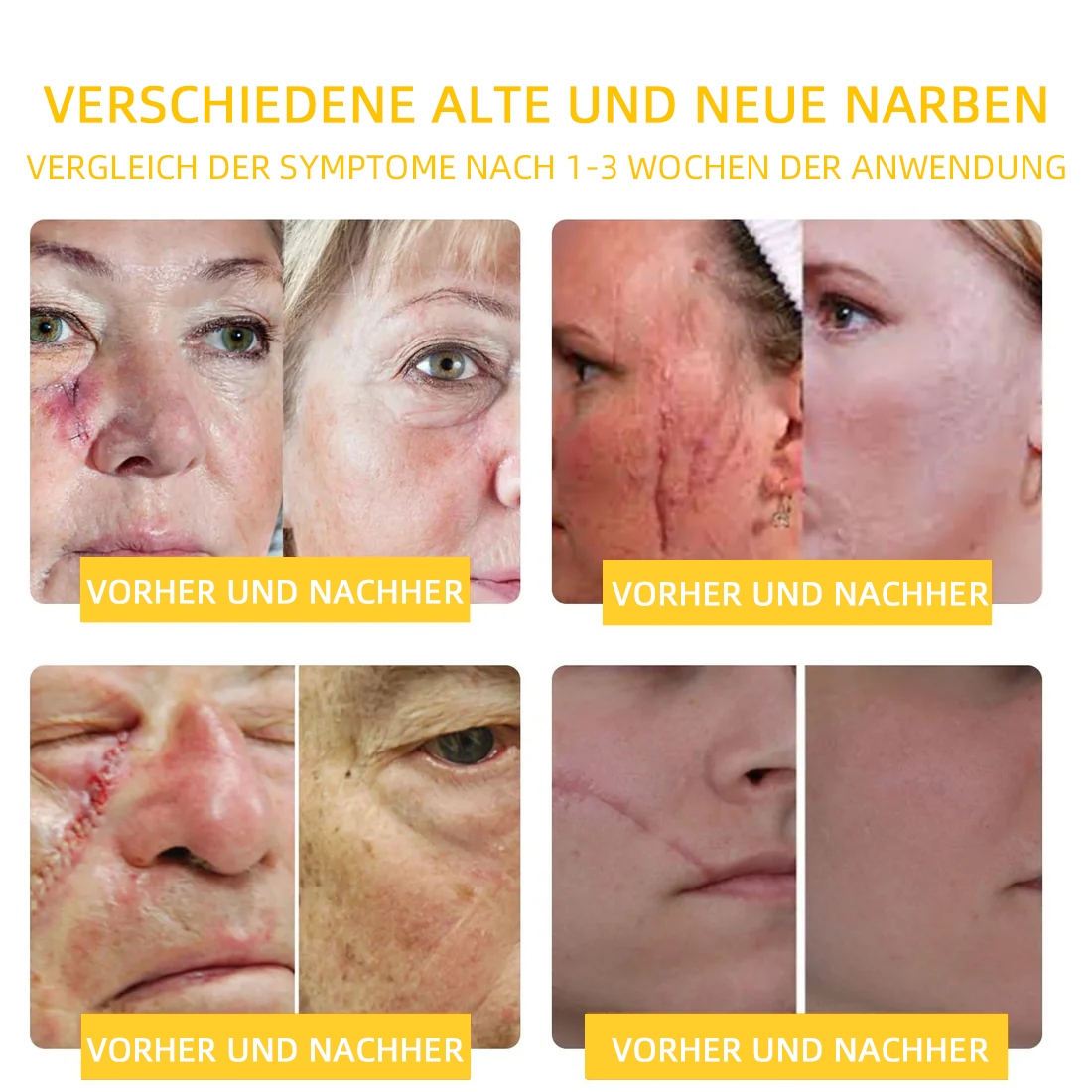 💎Turonu™ Bienengift Hautpflegecreme( BfArM Deutschland)💎