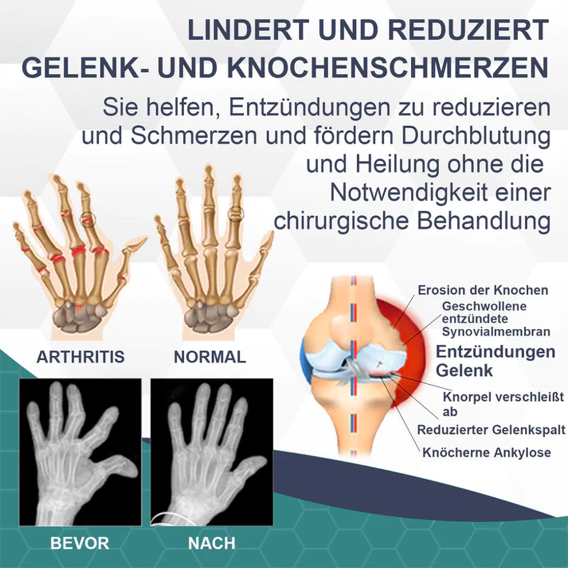 🐝🤩🐝 Bienengift Schmerz- und Knochenbehandlungscreme 💥 30-Minuten-Sonderaktion🐝🐝🐝 ⚡
