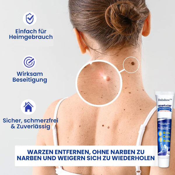 Dobshow™ WartsOff Rapid Creme zur sofortigen Entfernung von Hautunreinheiten