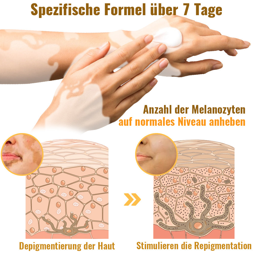Dobshow™ BeeVenom Vitiligo Behandlungscreme