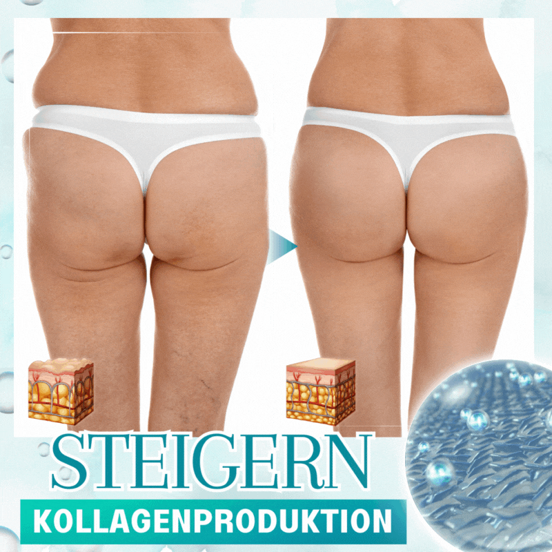 Dobshow™ Körpercreme gegen Schwellungen reduziert
