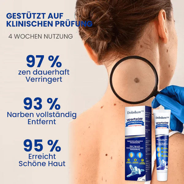 Dobshow™ WartsOff Rapid Creme zur sofortigen Entfernung von Hautunreinheiten