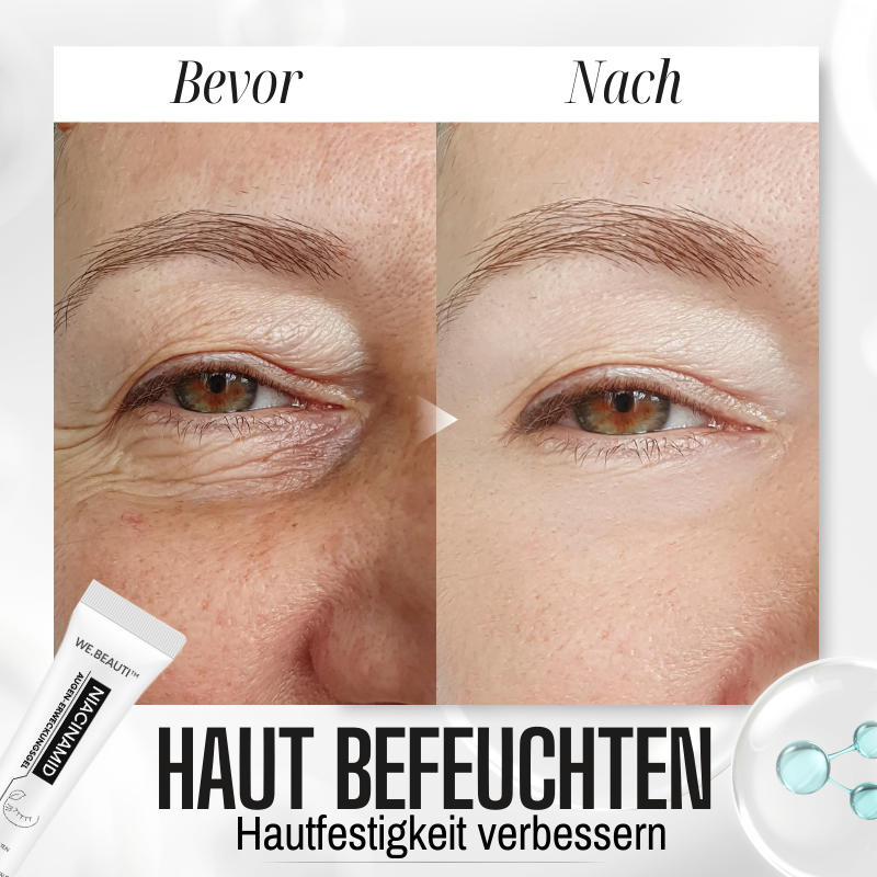WE.Beauti™ Niacinamid Augenerwachen Gel
