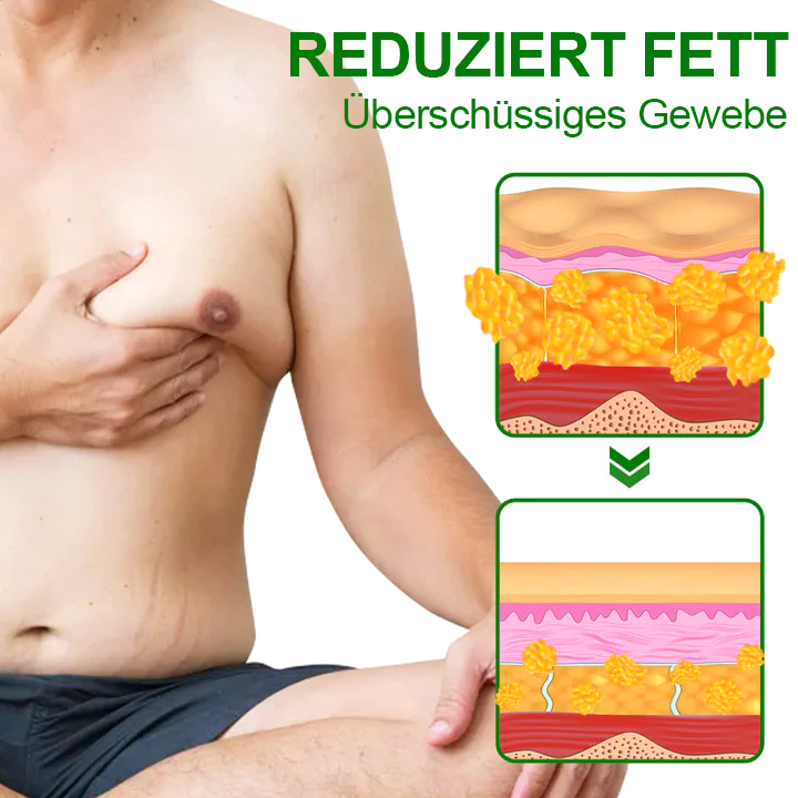 Dobshow™ TurmericMax Gynäkomastie-Kompressionspflaster🍃💪