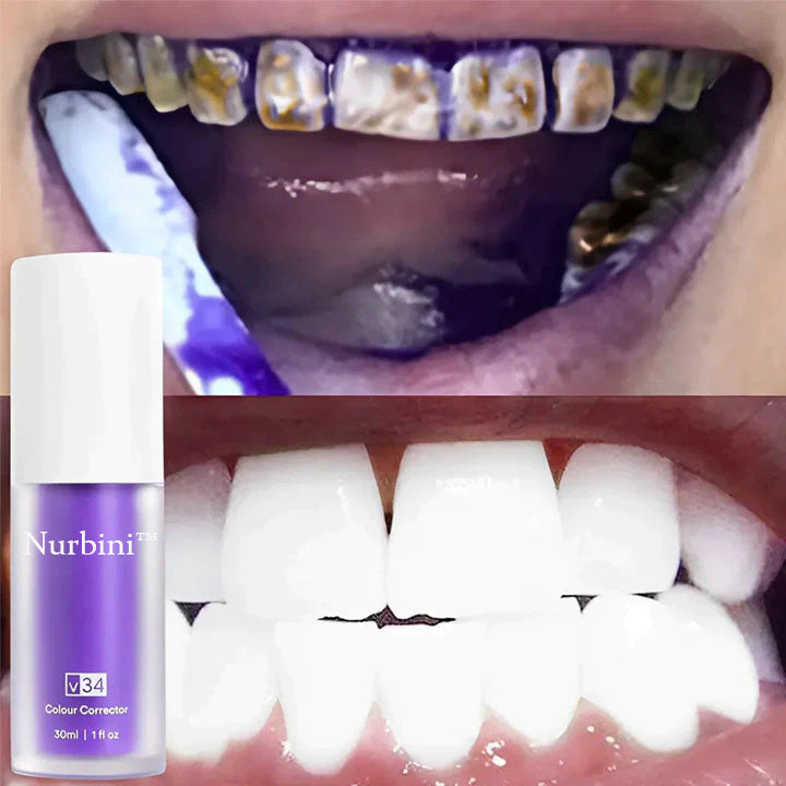 Nurbini™ Rein pflanzliches Zahnweiß-Mousse