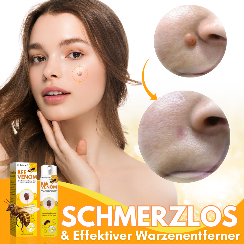 Dobshow™ Bienengift Hautperfektionsspray✨💛