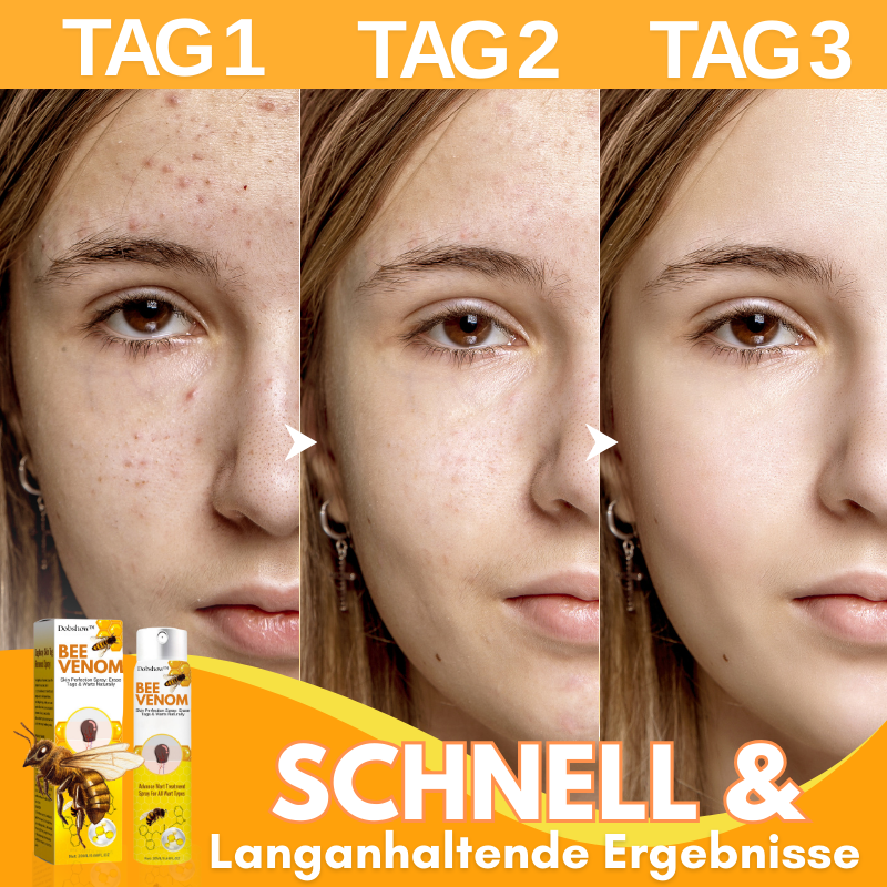Dobshow™ Bienengift Hautperfektionsspray✨💛