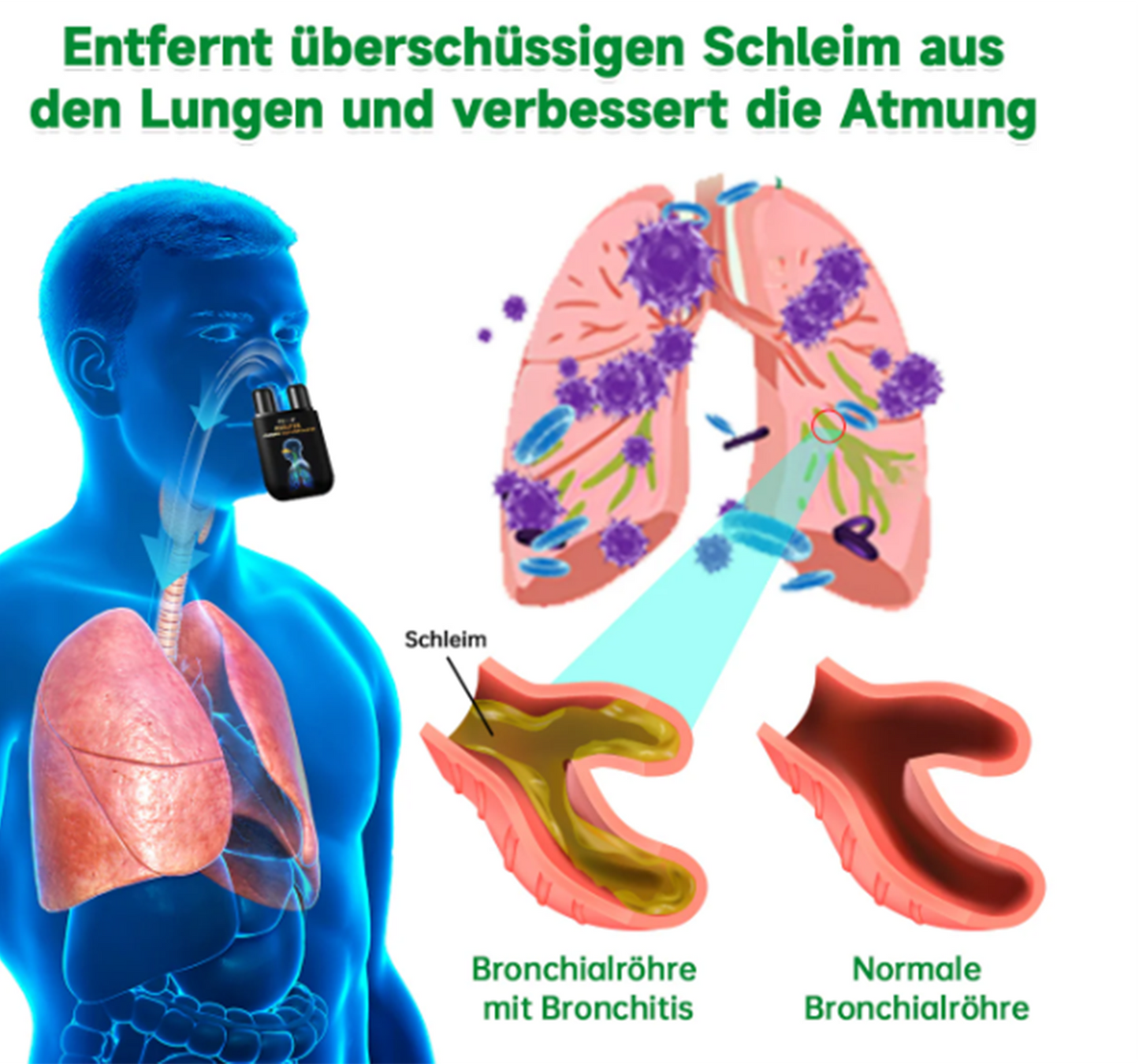 Dobshow™ 🧑⚕️herbal Lungenreinigungs-Inhalator🍃🍃