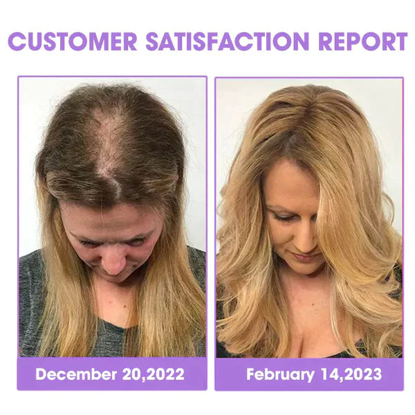 Nurbini™Gouttes de croissance des cheveux réparatrices des follicules pileux - Obtenez rapidement des cheveux plus épais