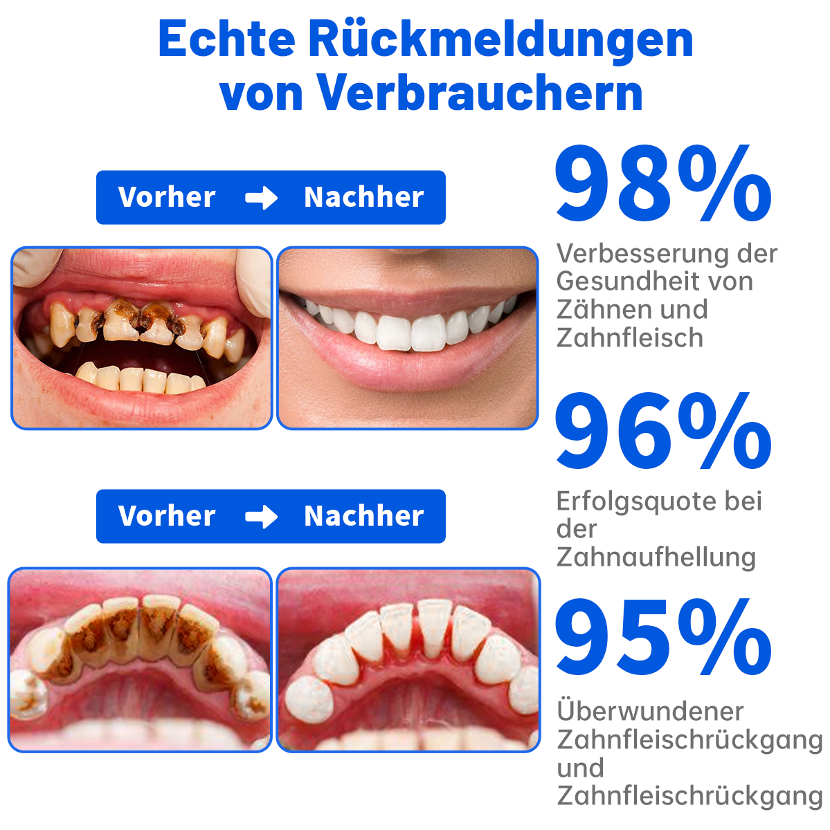 đŠ· Dobshowâą SmartSmile Bienengift-Zahnpasta zum Aufhellen und Reparieren