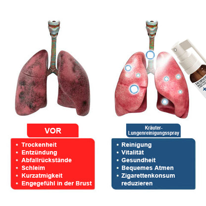 🌿Dobshow™ BreathDetox Kräuter-Lungenreinigungsspray
